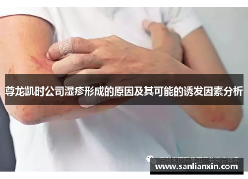 尊龙凯时公司湿疹形成的原因及其可能的诱发因素分析