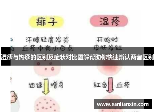 湿疹与热疹的区别及症状对比图解帮助你快速辨认两者区别